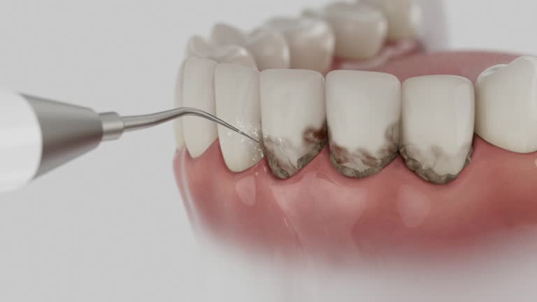 Reliable Dental contractor in Comanche, OK by Smile Center Dentistry